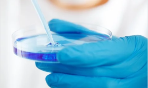 analisi liquido azzurro