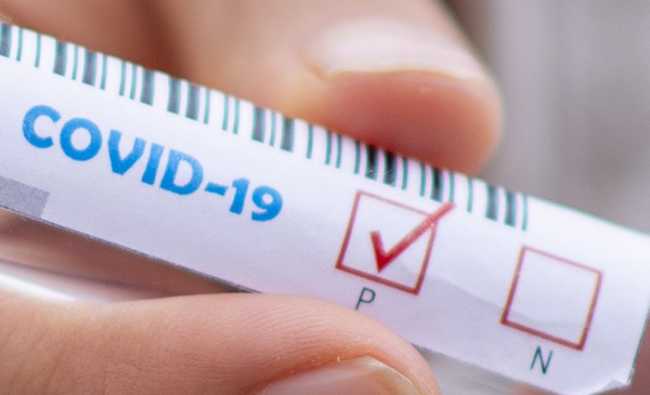 covid positivo test test tube 5065426